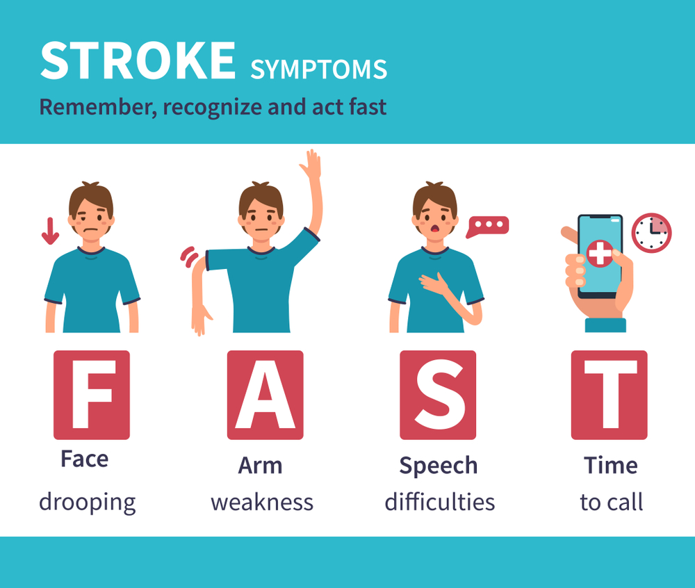 Facts about strokes are not always well known. The acronym FAST, as shown in this diagram, can help you recognize the signs of a stroke and act immediately. FAST stands for Face, Arms, Speech, Time.